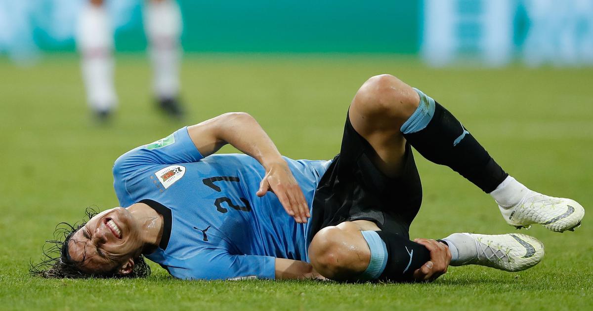 Edison Cavani: Uruguay worried by hamstring injury